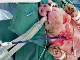 医工创谷企业动态：重大突破！国产双腔无导线起搏器研制成功，实现0到1原创性突破