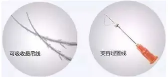 为什么有人做完筋膜提升后悔了，这些bug你有中吗？-筋膜提升有什么后遗症