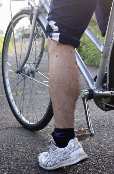 （男生的左腿被比特犬咬傷）