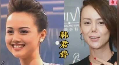 盘点被整容害惨的几位女星，看看谁最让人惋惜？