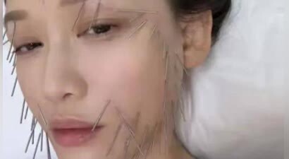 46岁陈乔恩针雕后现身！脸上满满胶原蛋白，令人惊叹效果显著