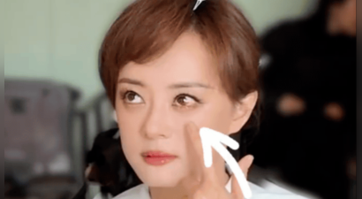 孙俪回应左眼受伤称“被球撞了”！