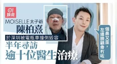 香港富二代遭车祸严重毁容，近照面目全非，自曝曾找十多位医生修复