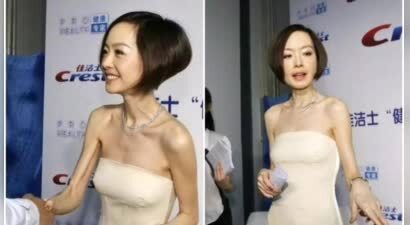 8位“纸片人”女星瘦成皮包骨，为何仍对这种状态“上瘾”？