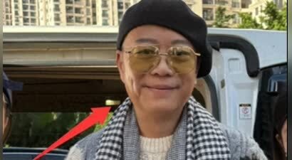 TVB视帝亮相广州，眼圈肿胀为粉丝签名，自曝曾因脸“生蛇”崩溃