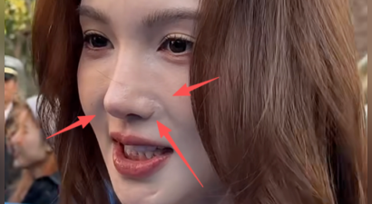 金晨怼脸拍鼻翼疤痕明显，妆浓到卡粉都遮不住，网友劝她收手