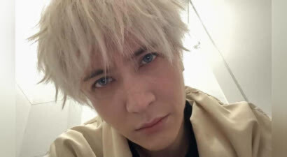 薛之谦自曝满头斑秃和水泡：其实第一天演出前，我头发都染断了