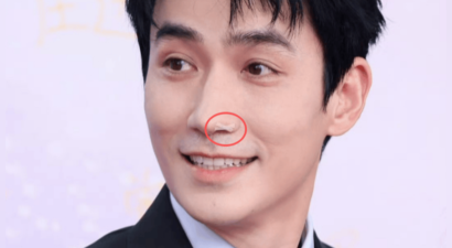 朱一龙拍摄动作戏意外撞伤鼻子 及时医治现已恢复良好