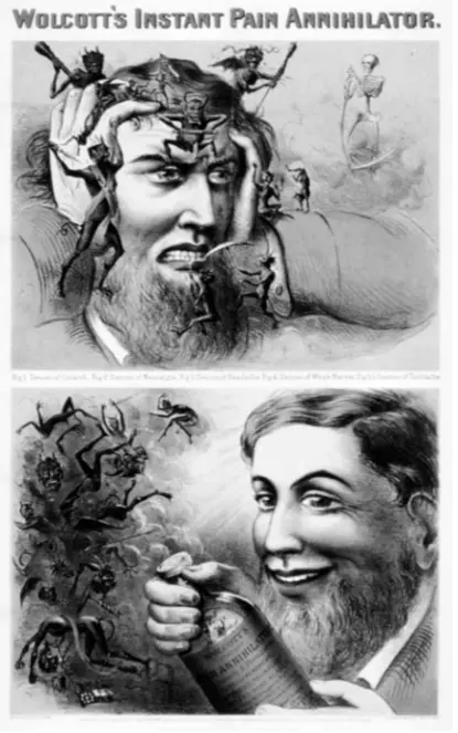 沃尔科特的瞬间止痛剂（约1863年），对它的营销是：一种武器，可以杀死敲打和刺穿患者头部的恶魔。这五个恶魔是黏膜炎、神经痛、头痛、神经衰弱、牙痛。（图/《疼痛的故事》）