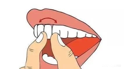 高伟丽详解| 牙周病的7大典型症状和治疗方法(牙周病最有效的治疗措施)