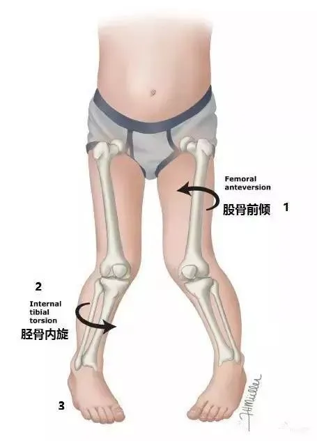 太疯狂了（恶搞怀孕快生了）怀孕搞笑生小宝宝视频 第12张