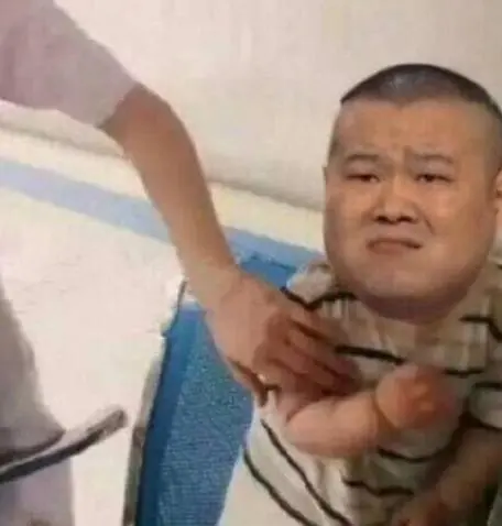 全脸超声刀多少钱？三分钟让你了解它-全面部超声刀