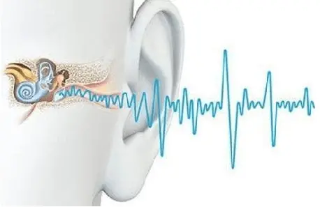 骨传导概念耳机是什么意思？不伤耳朵骨传导耳机品牌推荐！-骨传导耳机有危害么2