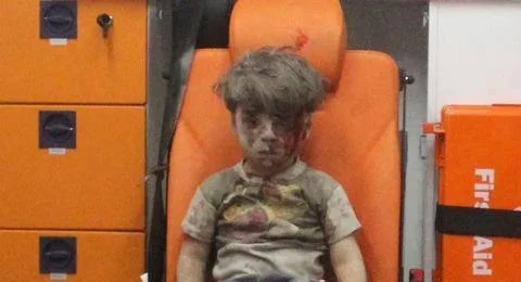 “白头盔”拍下的叙利亚男童奥姆兰的照片，他满面灰尘、脸部有血迹。