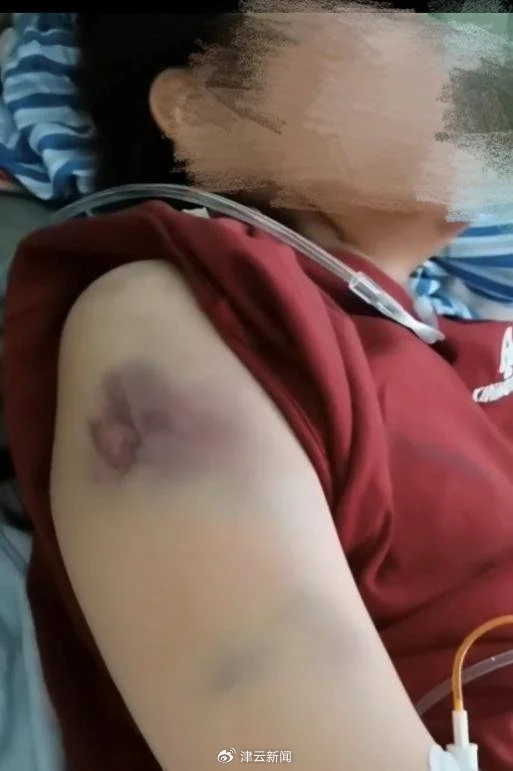 女子遭家暴开车逃跑撞死丈夫，父亲：望判女儿无罪