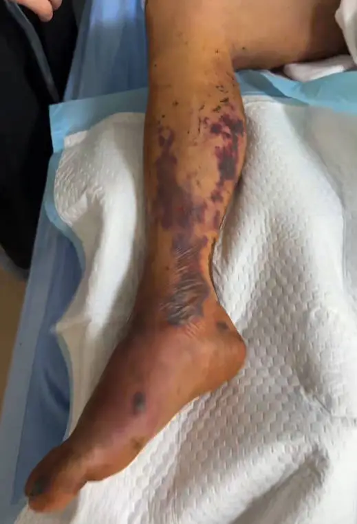 �����µس��ݱ�����ҧ�� �����ܷ���.jpg