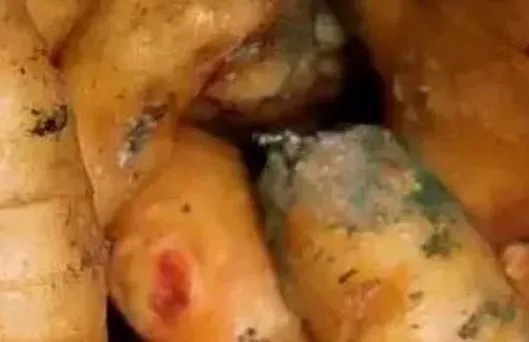 世界公认的第一类致癌物没想到是它，打死都猜不到！（致癌最强的物质是什么）