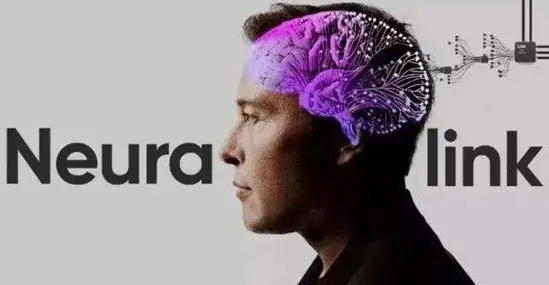 Neuralink首例受试者：无需手术升级脑机接口 类似特斯拉OTA更新