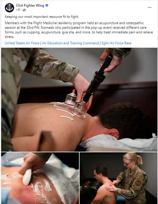 ▎ 这组照片引发了不少国内网友热议，大部分人好奇美军竟然也使用此类在中国街头巷尾随处可见的医疗手法 。