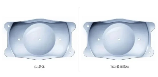 福州普瑞林青鸿ICL晶体植入手术的ICL和TICL有什么区别？