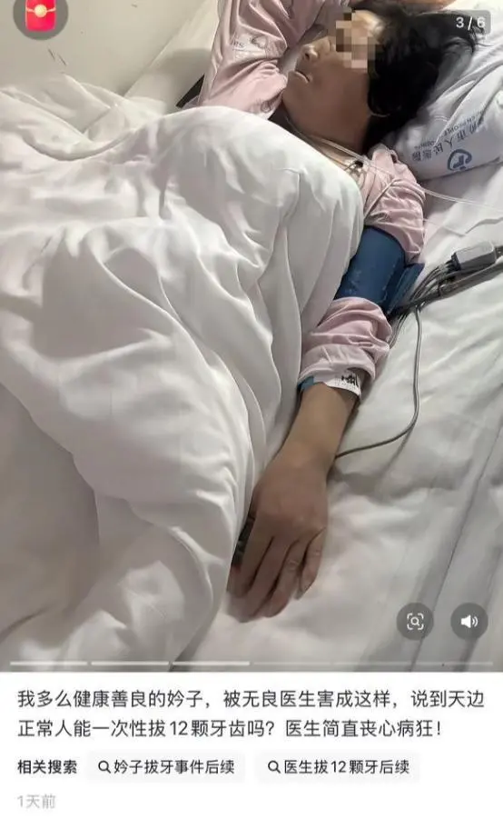 一次拔牙12颗女子心梗休克,拔牙岂是“拔萝卜”？