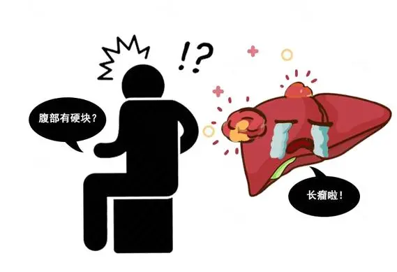 肝癌早期有征兆，5个征兆若你表现明显，不妨去排查下，别耽误-肝癌的早期有什么症状?