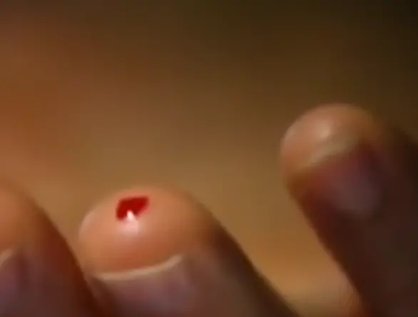 5 毫米的咬痕（图源：YouTube）