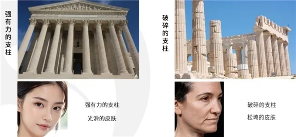 想做拉皮？首选北京嘉美信马双飞-贝壳无痕筋膜提升
