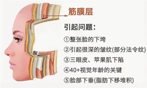 想做拉皮？首选北京嘉美信马双飞-贝壳无痕筋膜提升