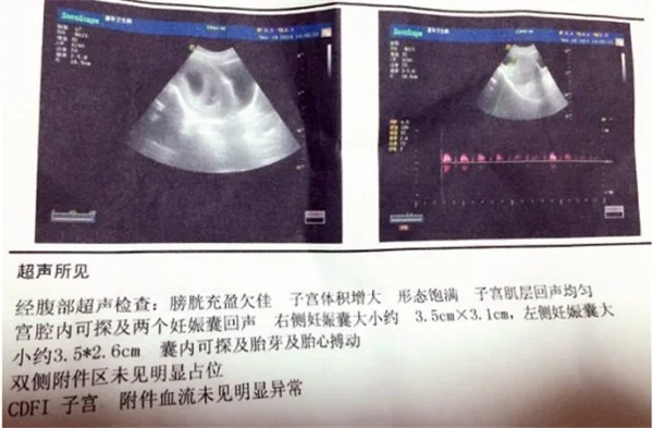 没想到（可乐可以验孕）喝可乐会验出怀孕吗 第4张