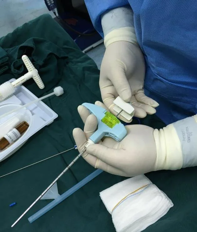 跑了7家医院才确诊 我的肋骨“虫蚀样病变”到底是个什么病？