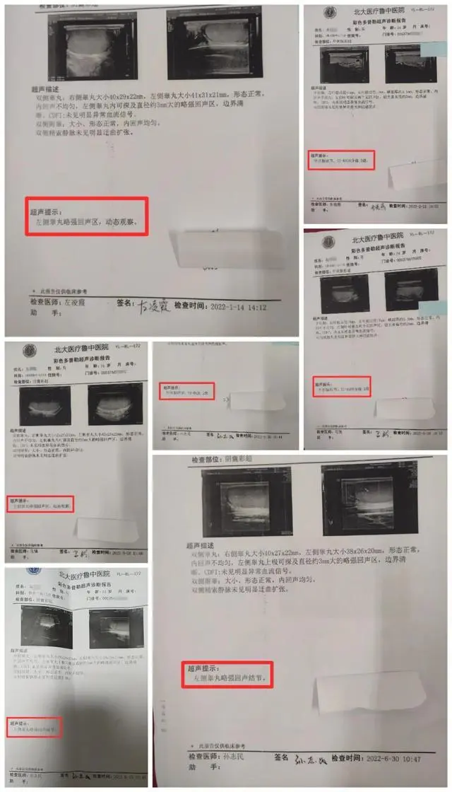 吴先生受试后的多次检查结果显示有异常 受访者供图