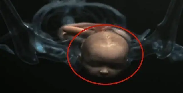 孩子是咋从那么窄的产道出生的？组图播放全过程，太心疼！(产道那么小,婴儿是怎么出来的呢?)