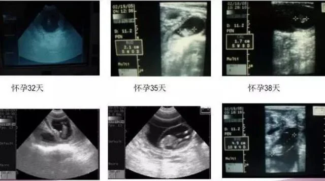 难以置信（醋和可乐验孕棒）验孕棒用饮料测也是两条杠 第8张