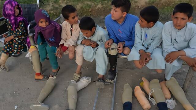 阿富汗战争遗魇 一家10个孩子被炸残