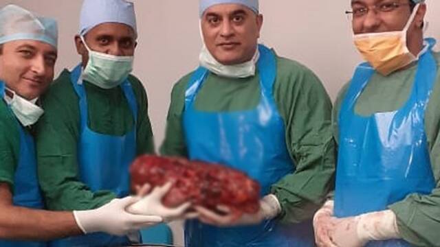 印度医生从患者体内取出7.4公斤巨型肾脏