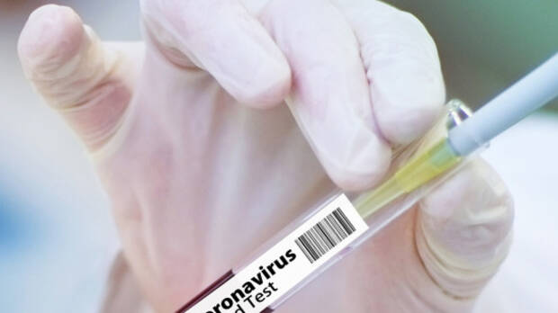 世卫：全球合作研发 2021年底前将提供20亿剂新冠疫苗