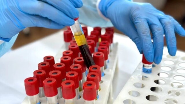 临床医生不能开检查套餐了？卫健委发文：应拆尽拆