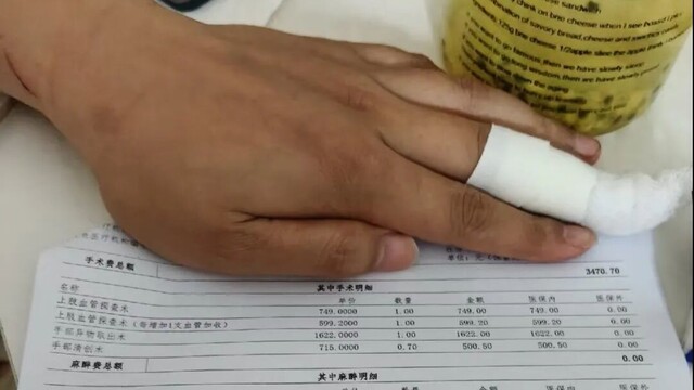 看健 | 治疗1厘米伤口花4400元，到底贵不贵？