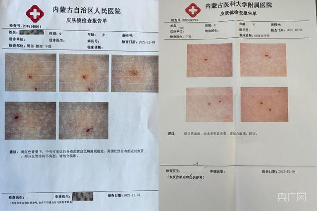 医院出具的检查报告单（央广网见习记者 刘晓祺 摄）