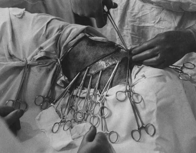 前苏联狗头移植实验