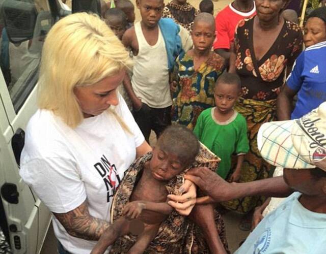 巫童被救助前后对比照