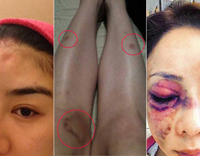 面对职业压力外,有些女星还要面对婚姻的压力,惨遭家暴被暴打时有发生