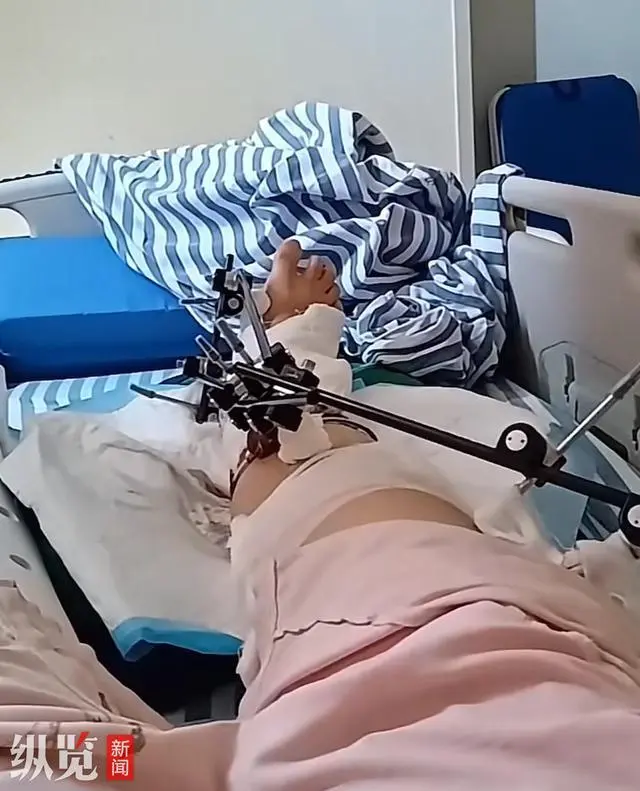 彭惠芳称她的右脚粉碎性骨折，左腿骨裂开。（来源/视频截图）