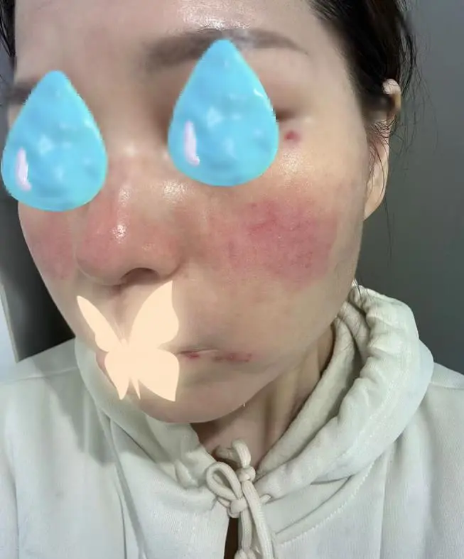 国货美妆巨头珀莱雅拟赴港上市：半年赚了8亿，打广告花掉26亿_https://www.izongheng.net_IPO_第7张