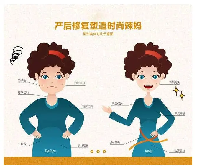 女性朋友生完宝宝后，到底要不要做产后修复-女性朋友生孩子