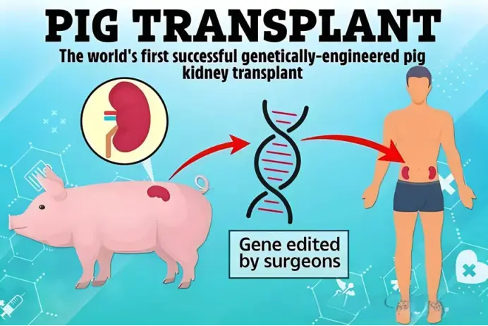 全球第二例猪肾移植患者去世 难破存活两个月魔咒？