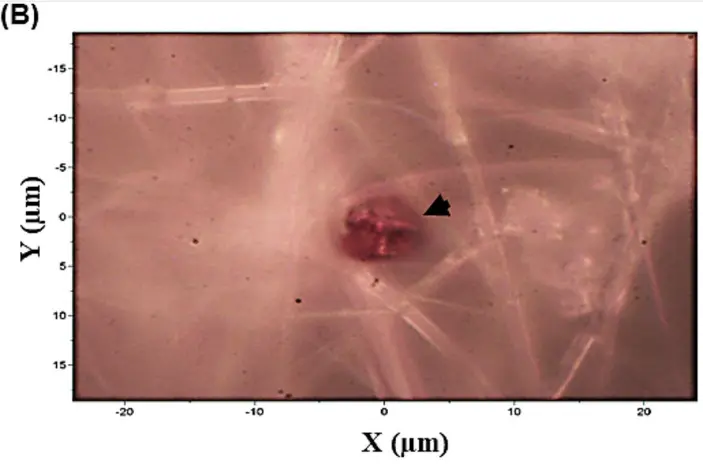 胎盤組織中所見微塑料顆粒 圖源：文獻 3