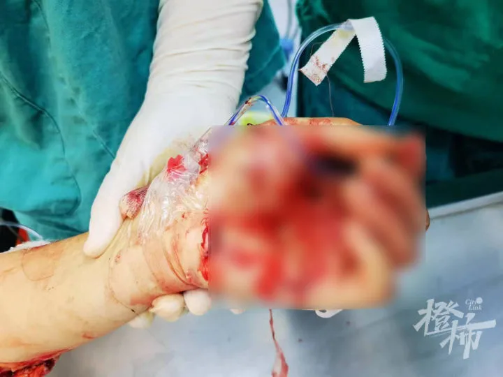 女子在公园门口被人连刺30多刀，嫌犯跳楼身亡