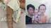 孩子被亲妈打进ICU父亲网上众筹 医生发声：太无耻